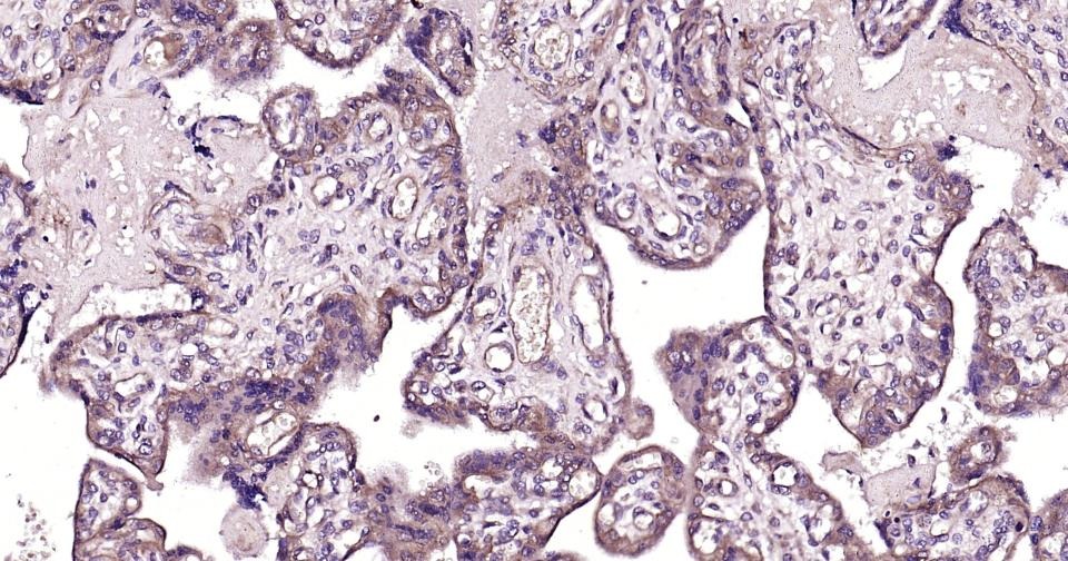 Anti-Phospho-TBK1 (Ser172) Polyclonal Antibody