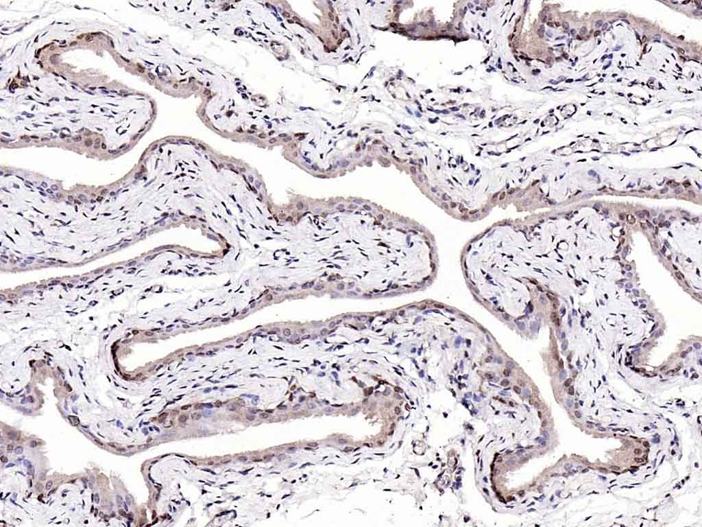 Anti-S100A4 Polyclonal Antibody