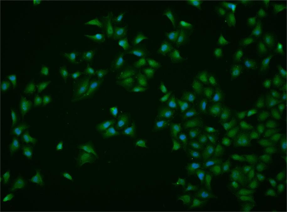 Anti-RAD51 Polyclonal Antibody