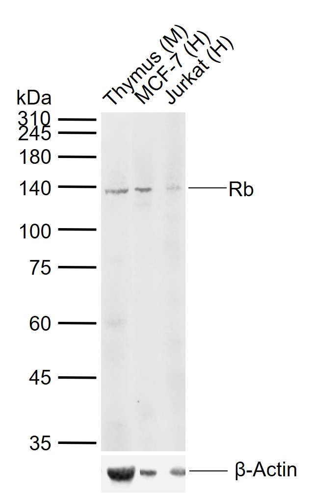 Anti-Rb Polyclonal Antibody