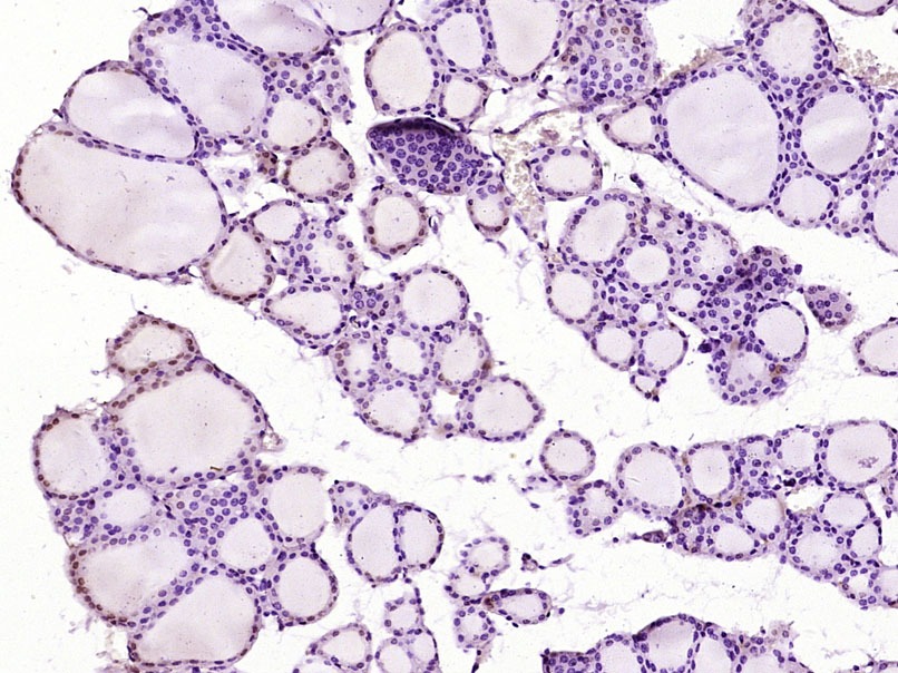 Anti-RUNX2 Polyclonal Antibody