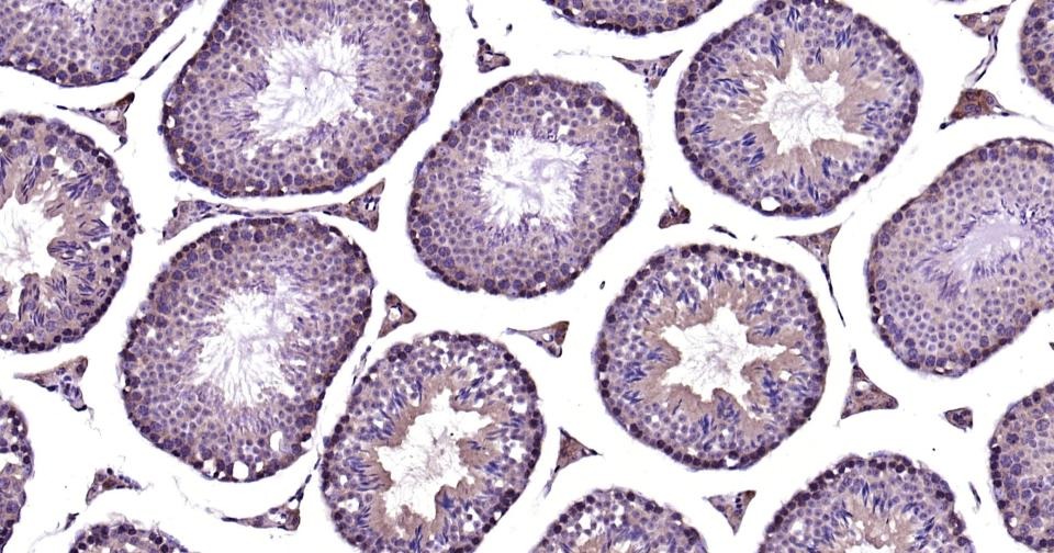Anti-Phospho-TBK1 (Ser172) Polyclonal Antibody
