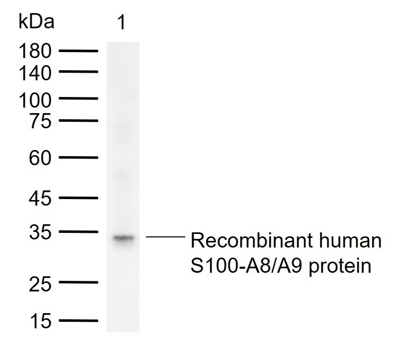 Anti-S100A8/9 Antibody (4J730)