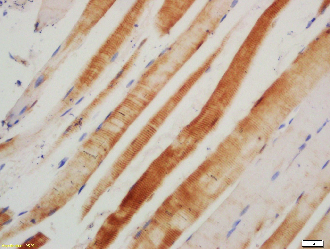 Anti-RAGE Polyclonal Antibody 2