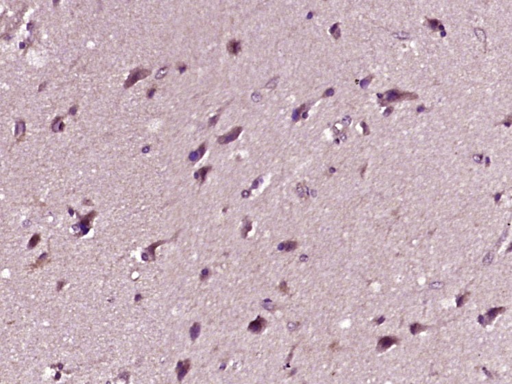 Anti-PRKN Polyclonal Antibody