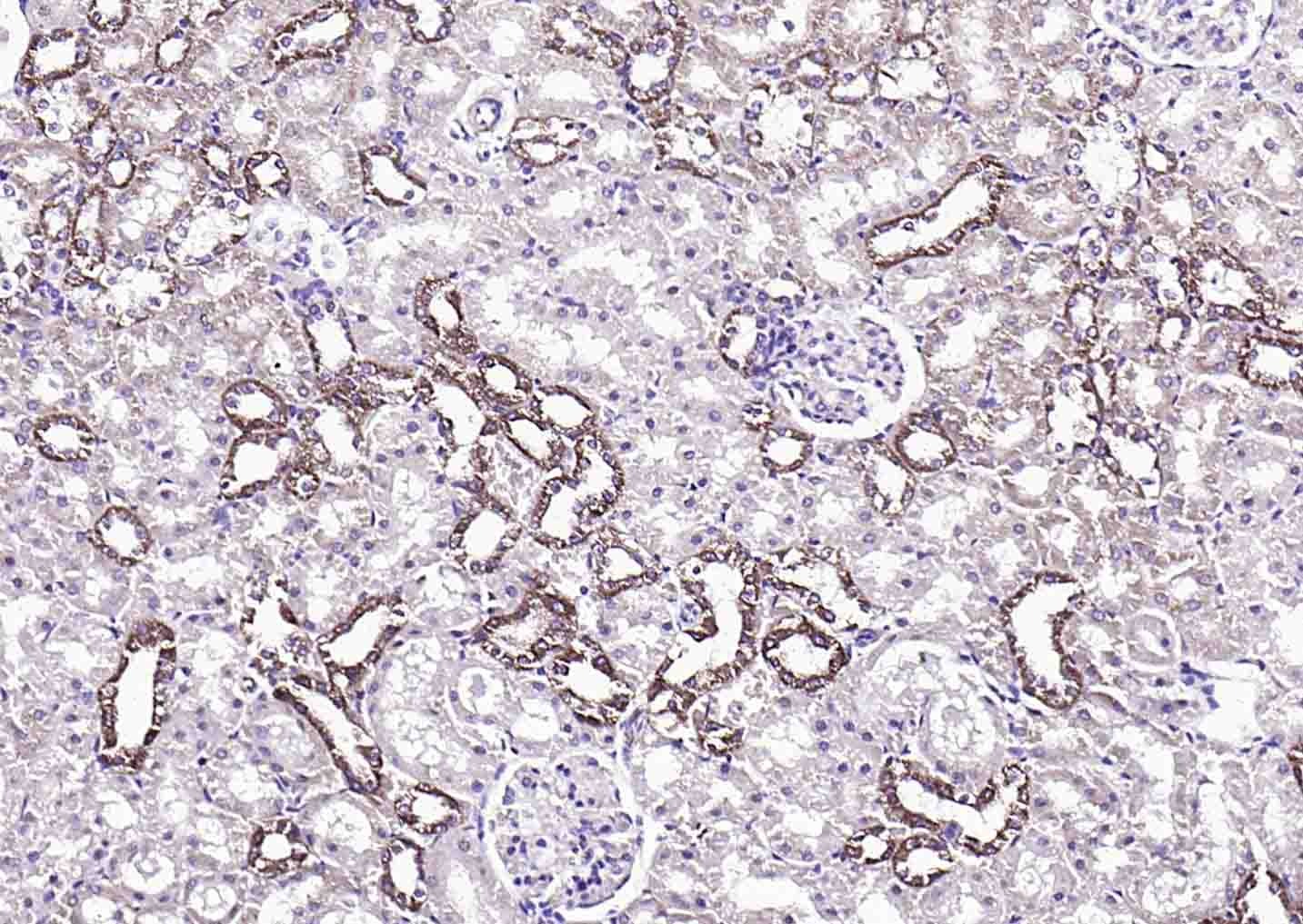 Anti-S100A10 Polyclonal Antibody