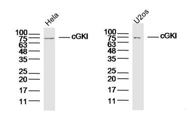 Anti-PRKG1 Polyclonal Antibody