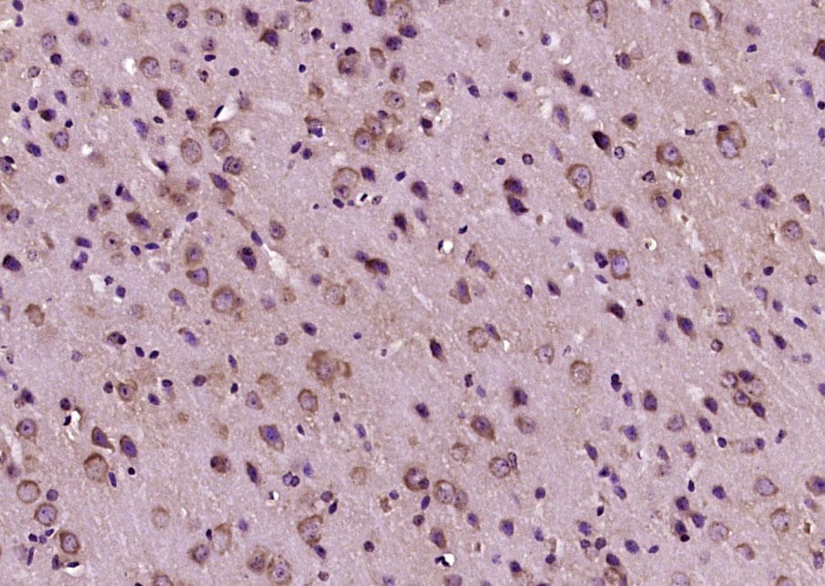 Anti-Calcitonin/CALCA Polyclonal Antibody