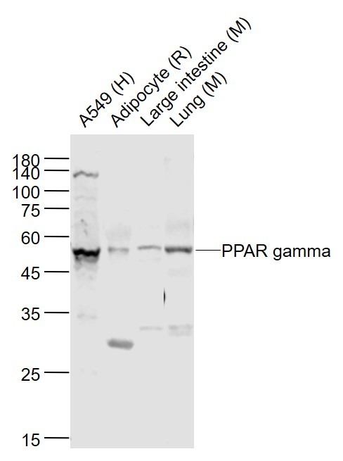 Anti-PPAR gamma/PPARG Polyclonal Antibody 2