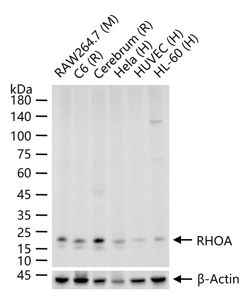 Anti-RhoA Antibody (4F916)