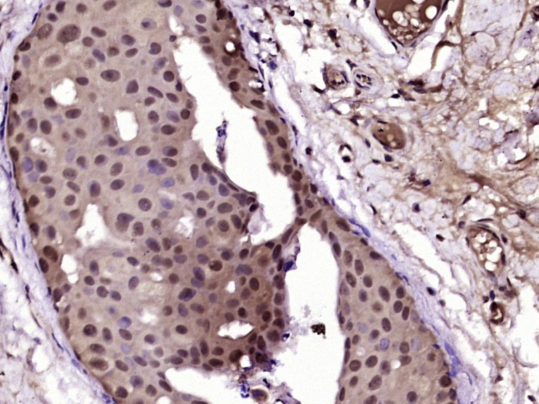 Anti-Progesterone Receptor Polyclonal Antibody