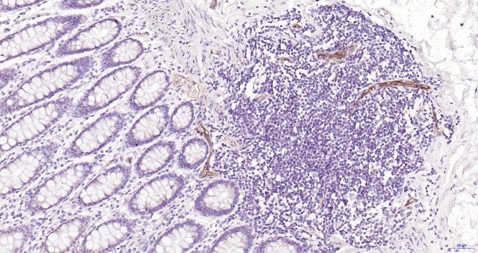 Anti-P-selectin Polyclonal Antibody