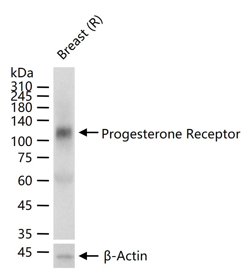 Anti-Progesterone Receptor Polyclonal Antibody