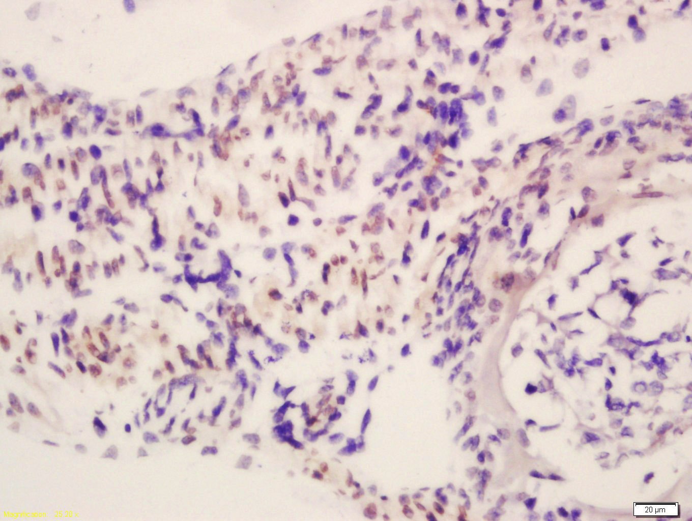 Anti-RBM20 Polyclonal Antibody