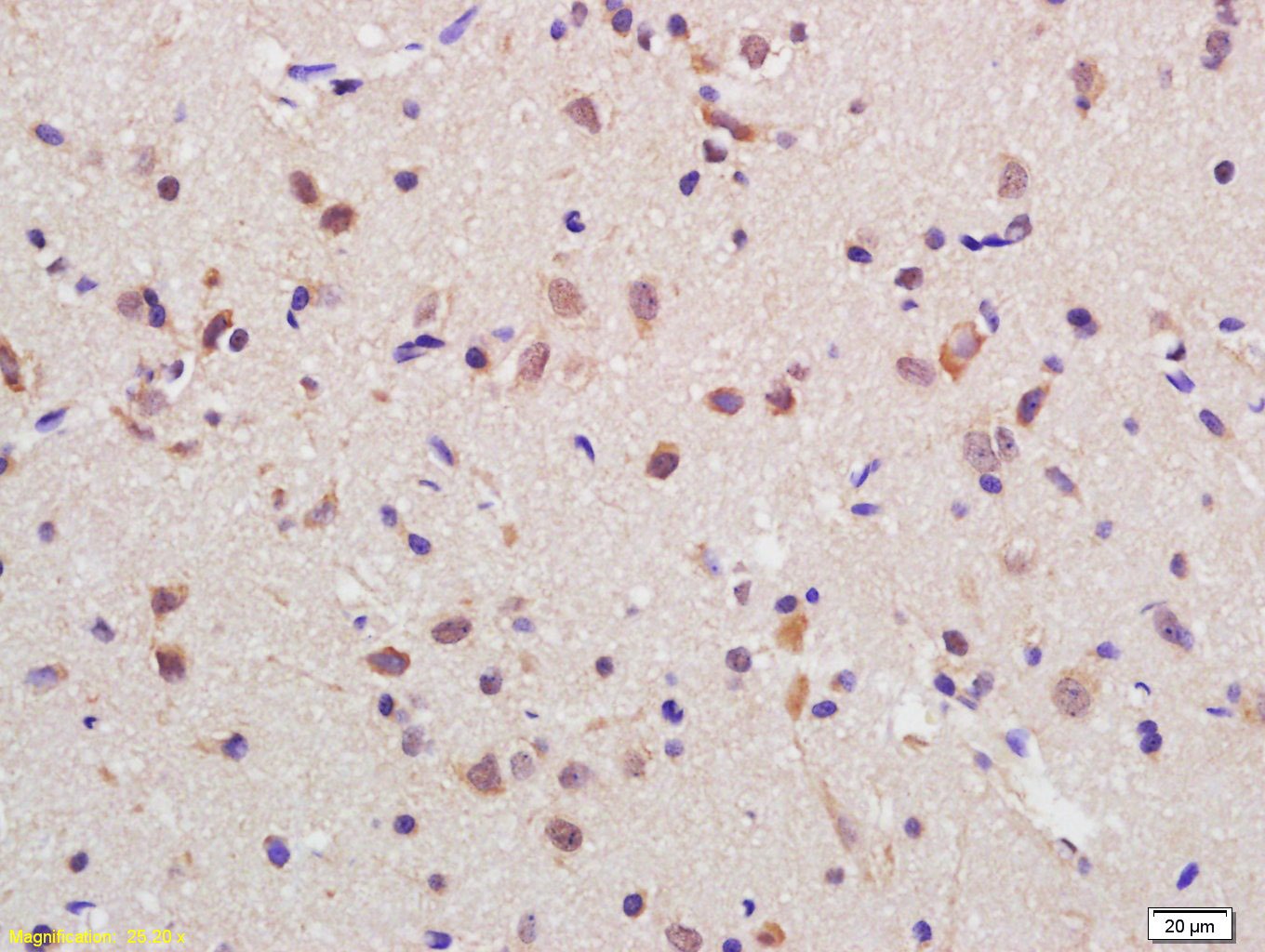 Anti-RGC32/C13orf15 Polyclonal Antibody