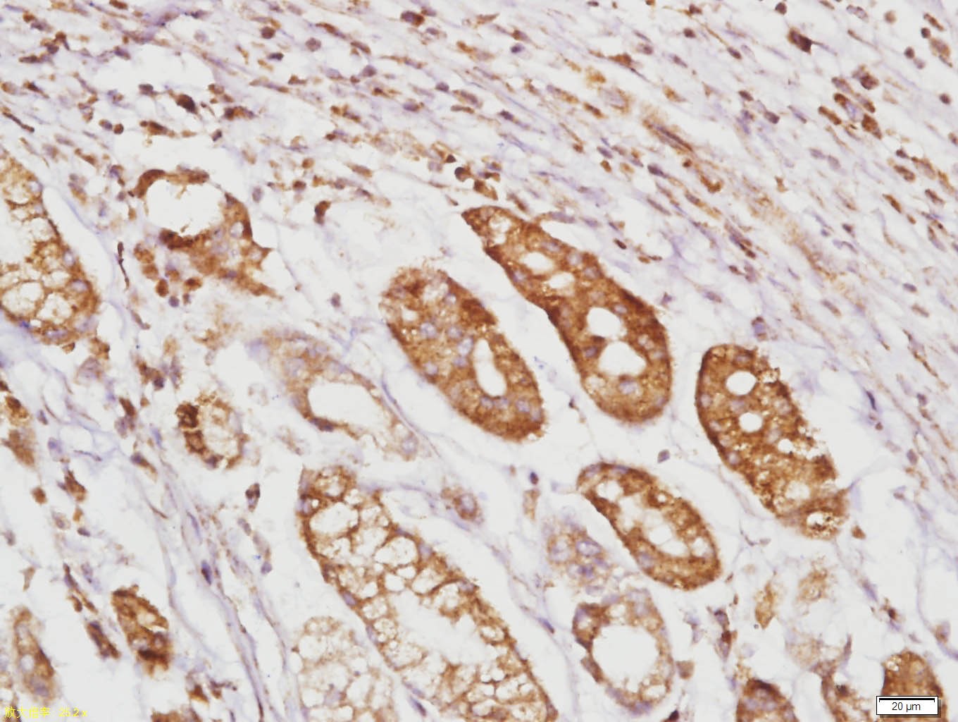 Anti-RhoA Polyclonal Antibody