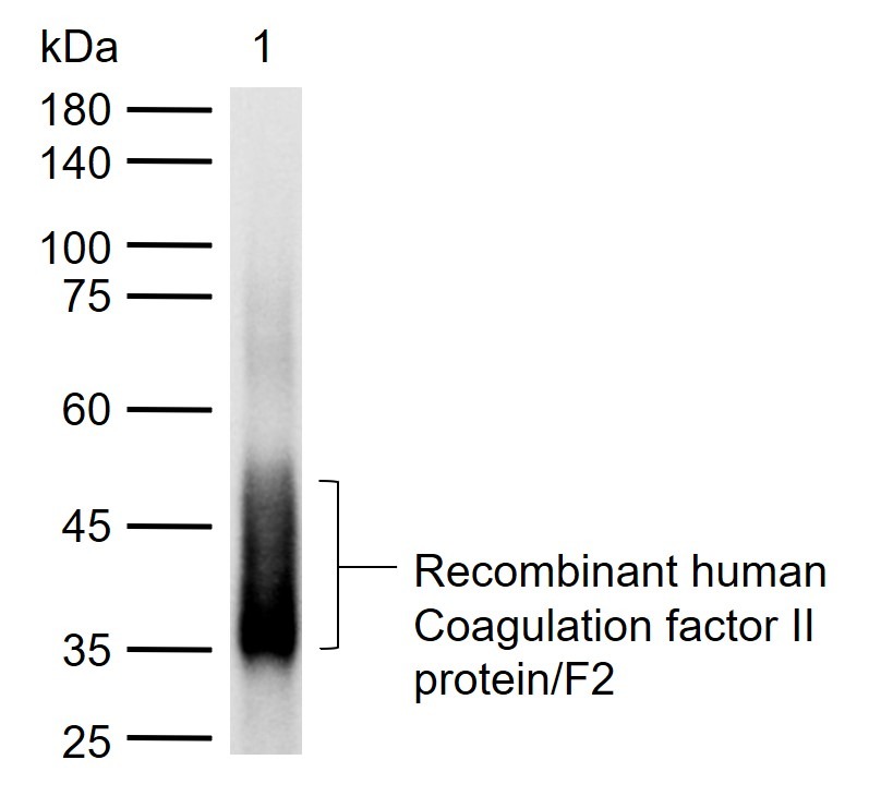 Anti-Prothrombin Polyclonal Antibody