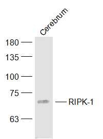 Anti-RIPK1 Polyclonal Antibody