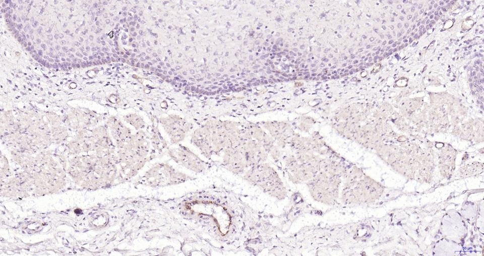 Anti-P-selectin Polyclonal Antibody