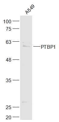 Anti-PTBP1 Polyclonal Antibody
