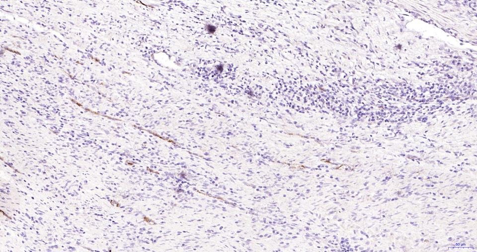 Anti-P-selectin Polyclonal Antibody