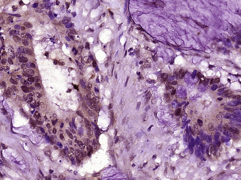 Anti-PTBP1 Polyclonal Antibody