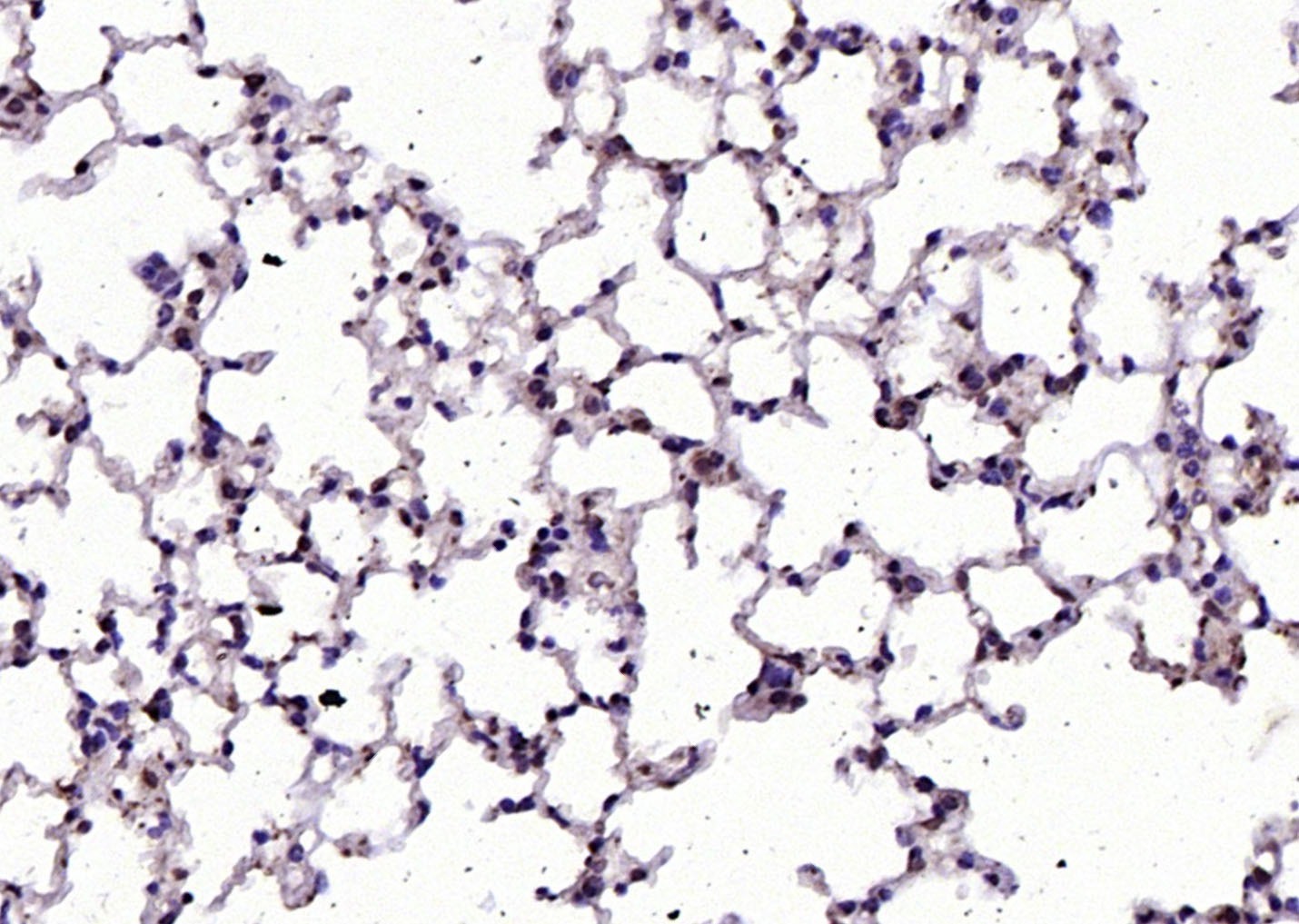 Anti-RGC32/C13orf15 Polyclonal Antibody