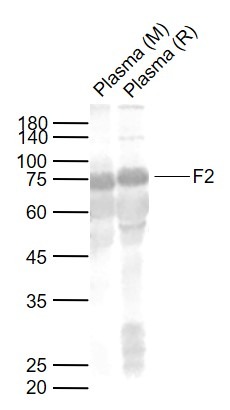 Anti-Prothrombin Polyclonal Antibody