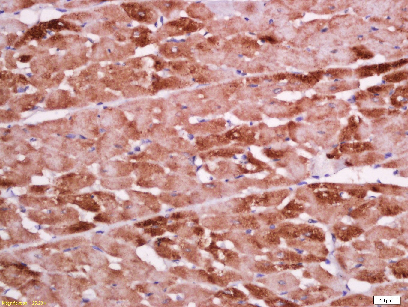 Anti-TnTc Polyclonal Antibody