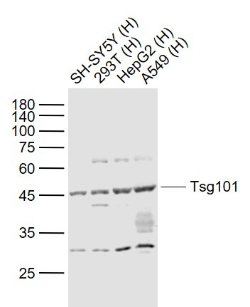 Anti-TSG101 Polyclonal Antibody