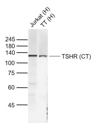 Anti-TSHR (CT) Polyclonal Antibody