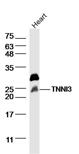 Anti-TNNI3 Polyclonal Antibody