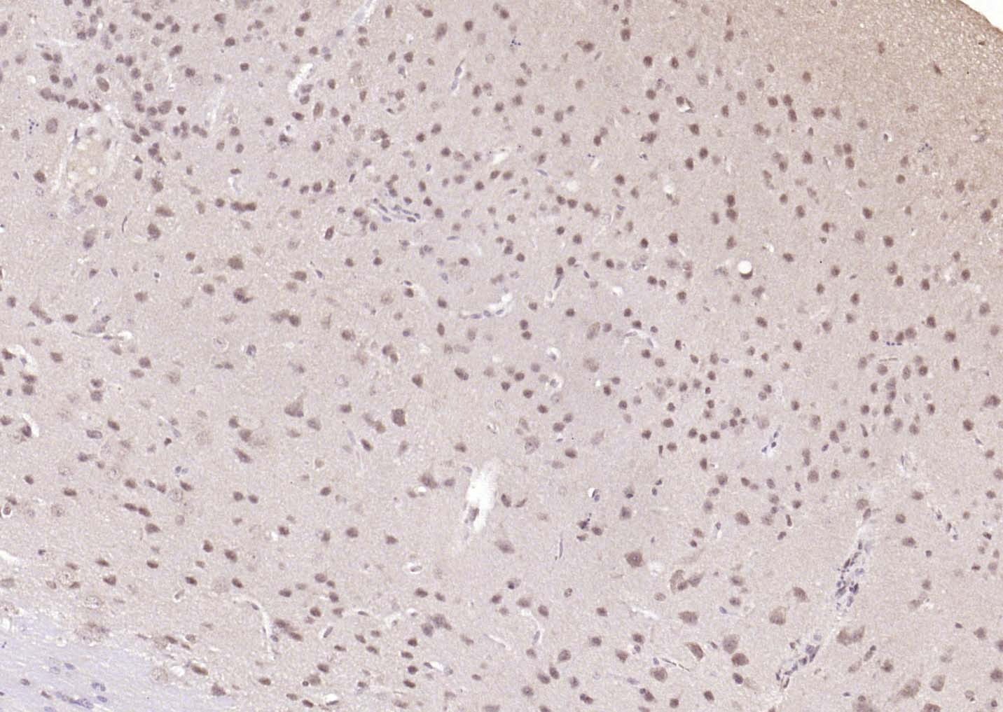Anti-TSG101 Antibody (3B556)