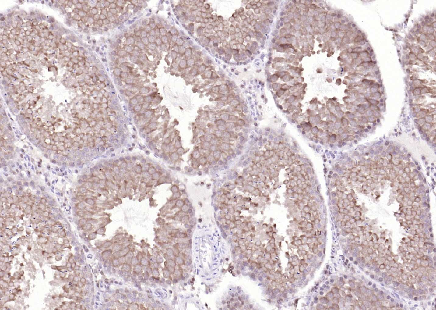 Anti-TSG101 Antibody (3B556)