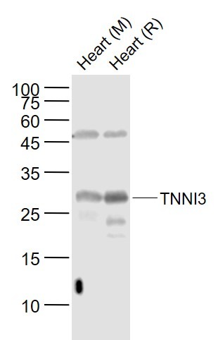 Anti-TNNI3 Polyclonal Antibody