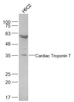 Anti-TnTc Polyclonal Antibody