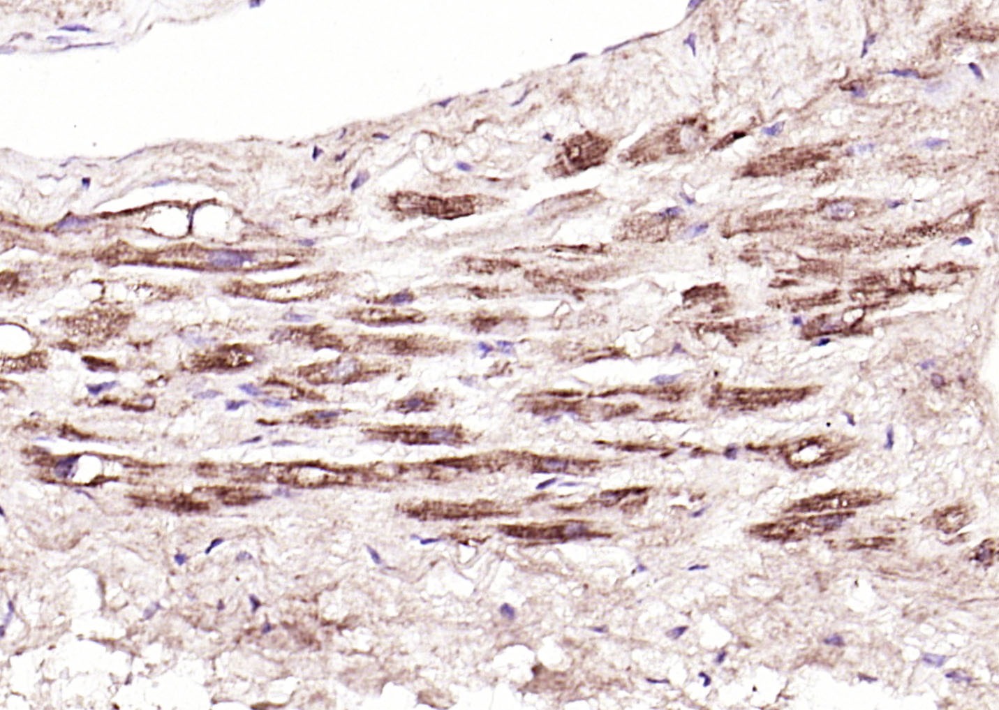 Anti-TSLP Polyclonal Antibody