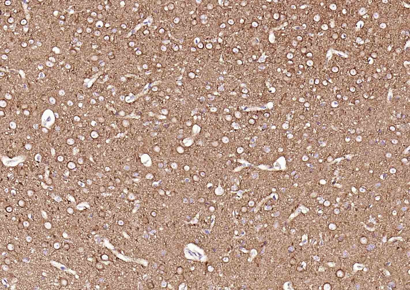 Anti-TUBB3 Antibody (1C239)