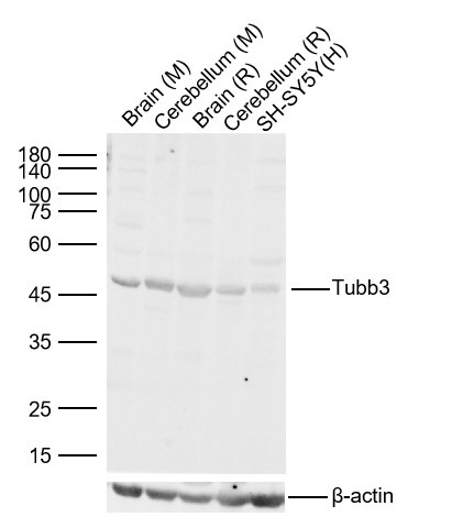 Anti-TUBB3 Polyclonal Antibody 2