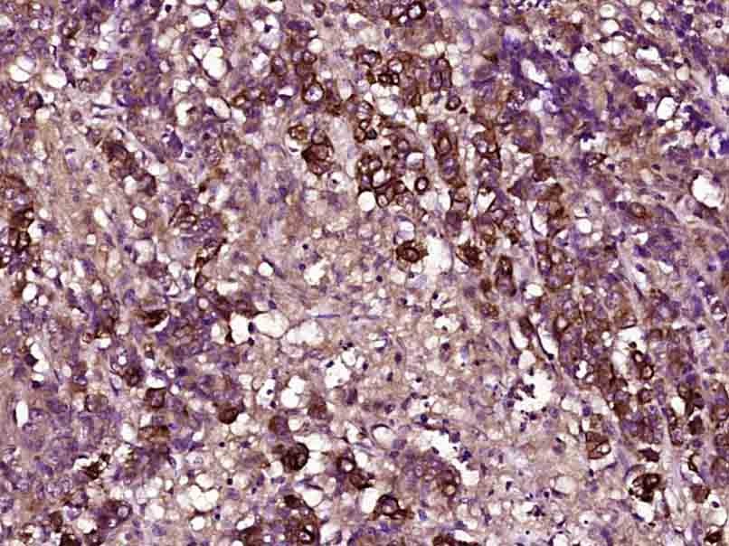 Anti-TIMP-1 Antibody (7V162)
