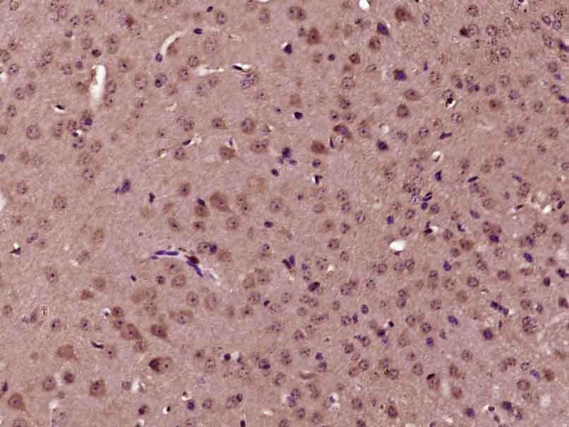 Anti-TIMP-1 Antibody (7V162)