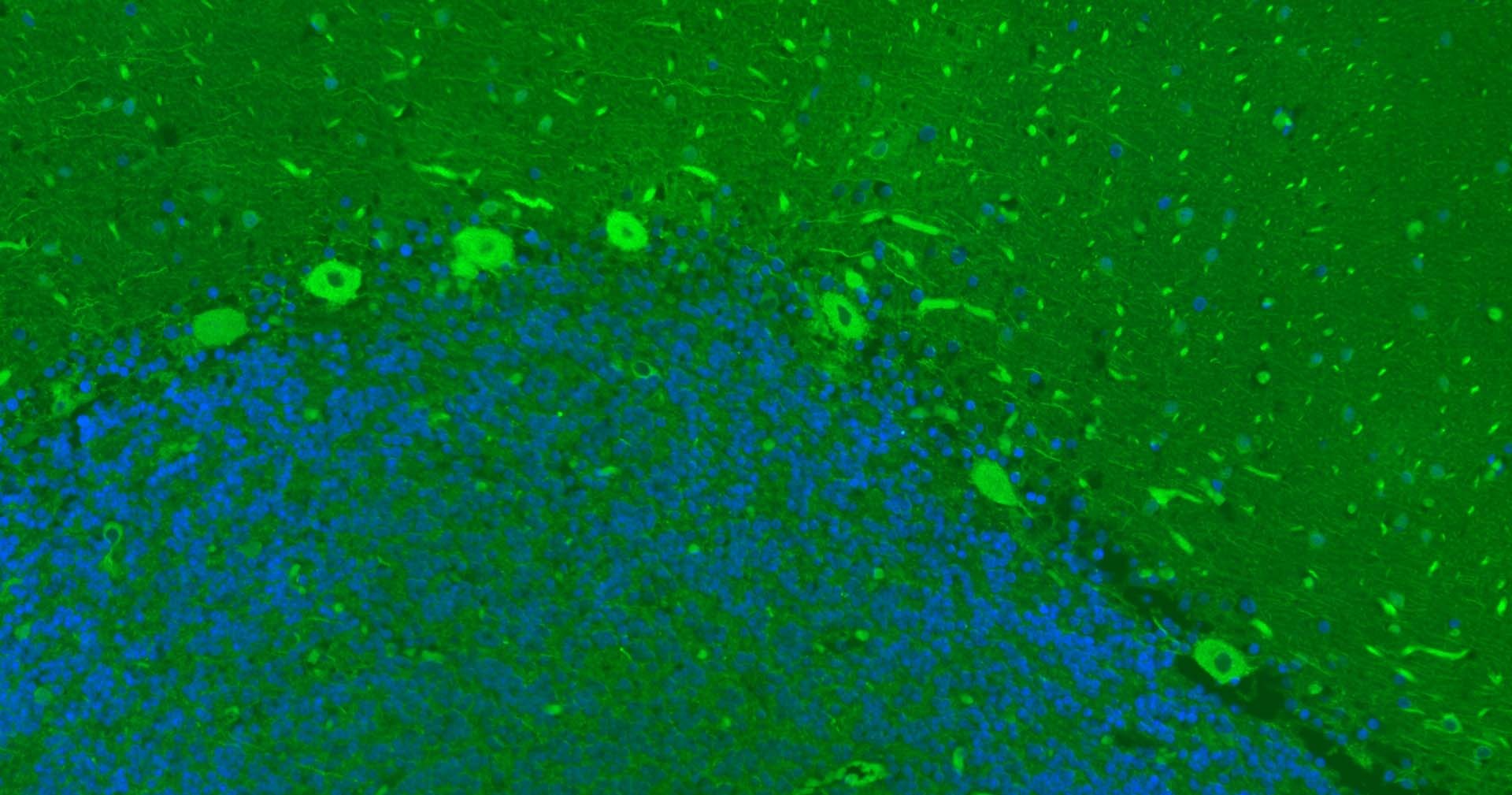 Anti-TUBB3 Antibody (1C239)