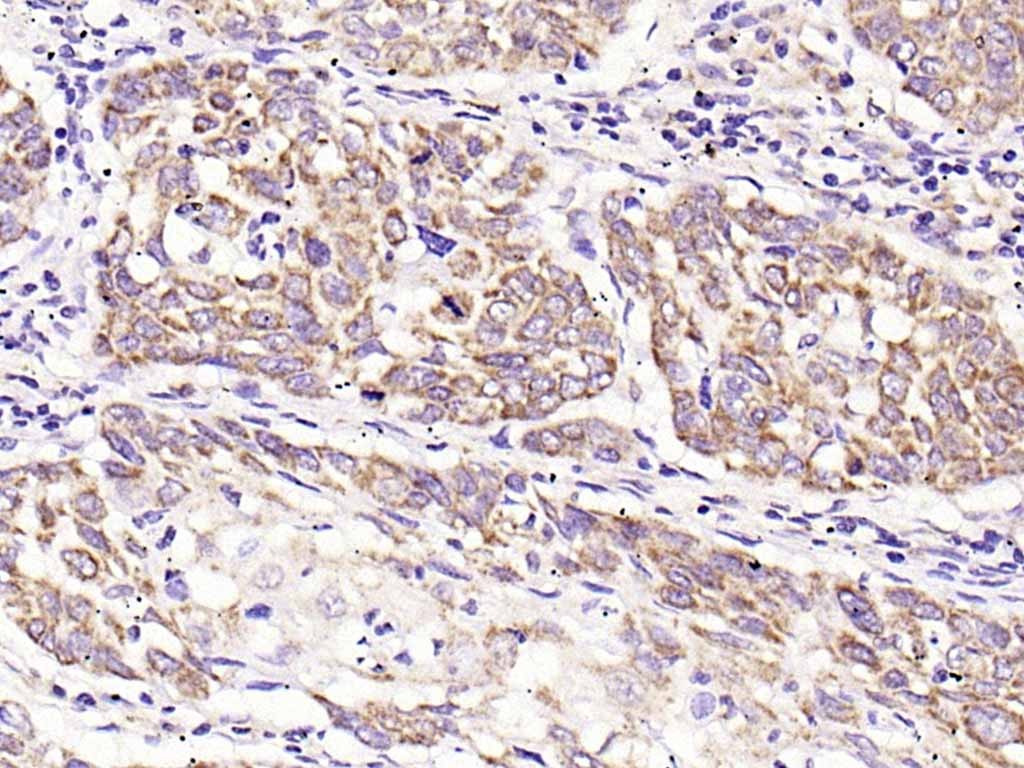 Anti-TIMP-1 Polyclonal Antibody 2
