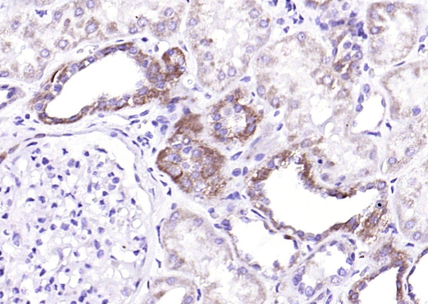 Anti-TSLP Polyclonal Antibody