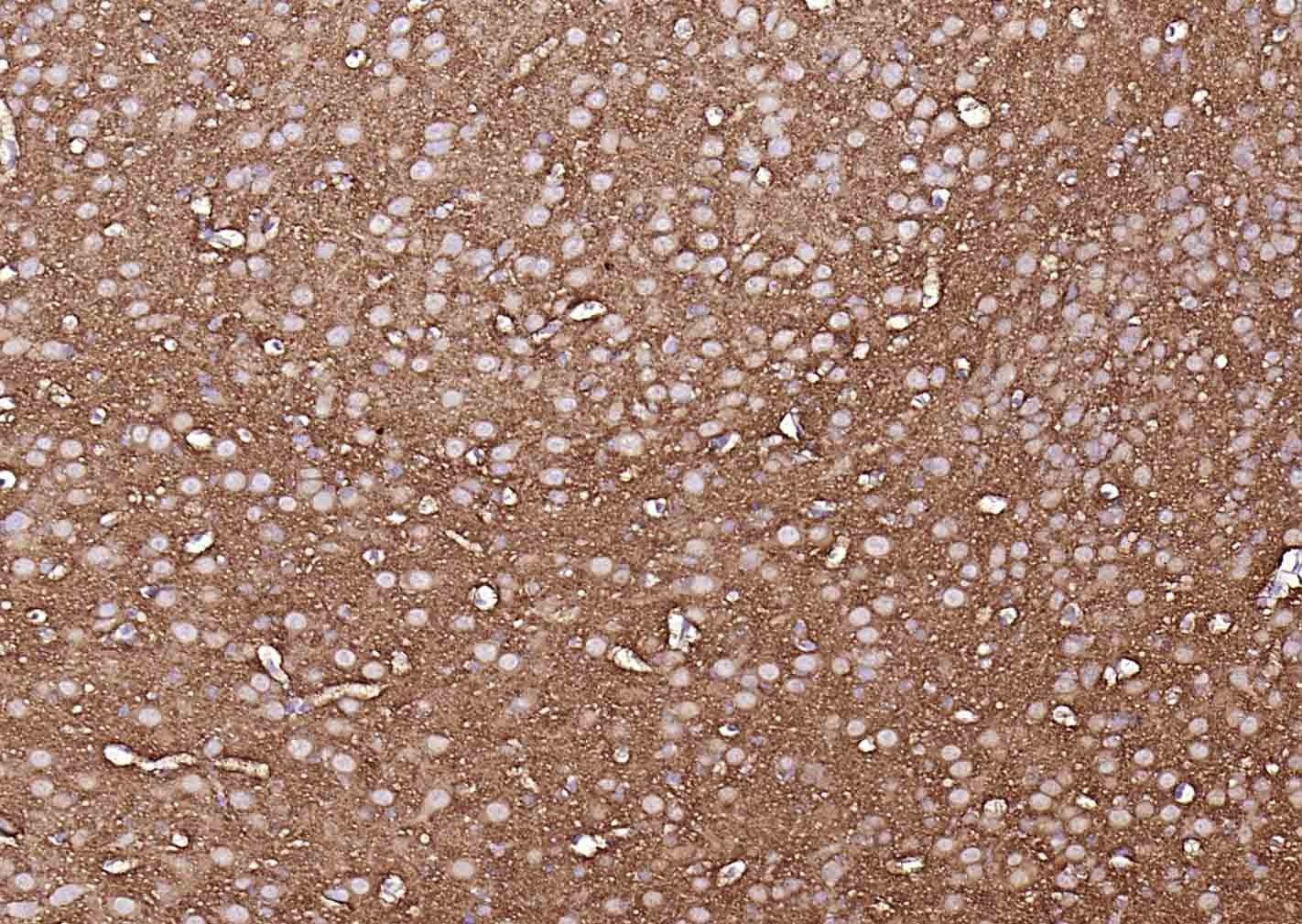 Anti-TUBB3 Antibody (1C239)