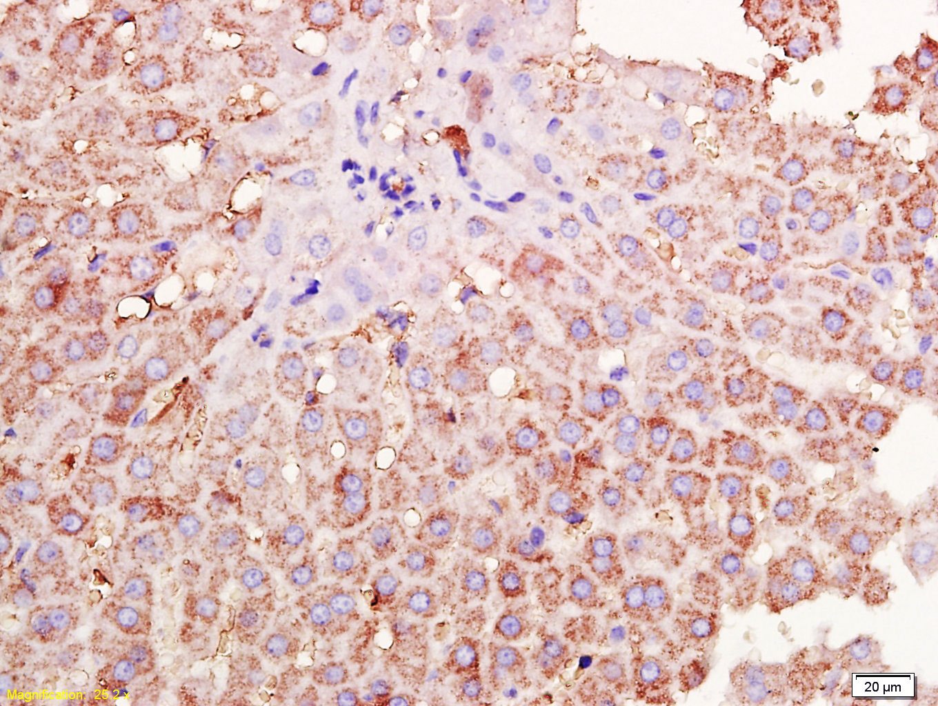 Anti-TIMP-1 Polyclonal Antibody