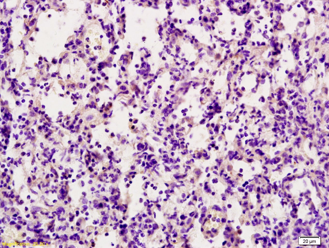 Anti-TRAIL/TNFSF10 Polyclonal Antibody
