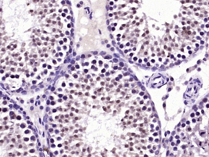 Anti-TKTL1 Polyclonal Antibody