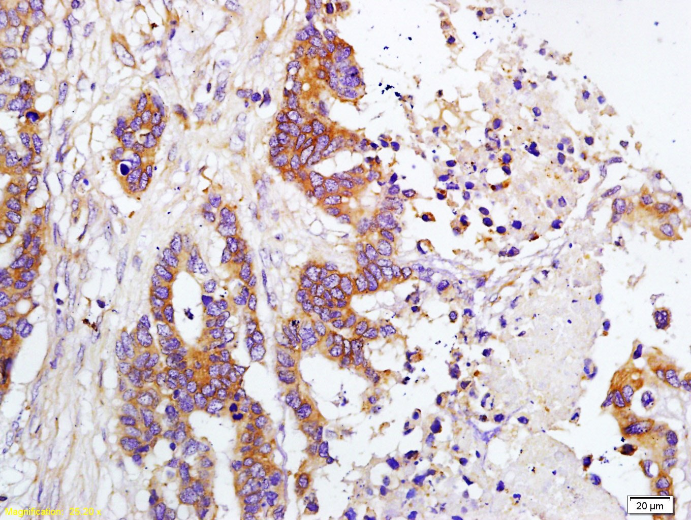 Anti-TIMP-1 Polyclonal Antibody
