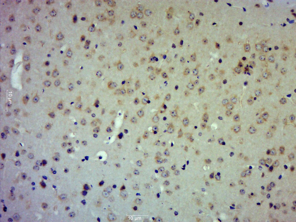 Anti-TIMP-2 Polyclonal Antibody
